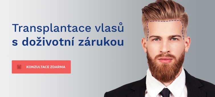 hairexpert