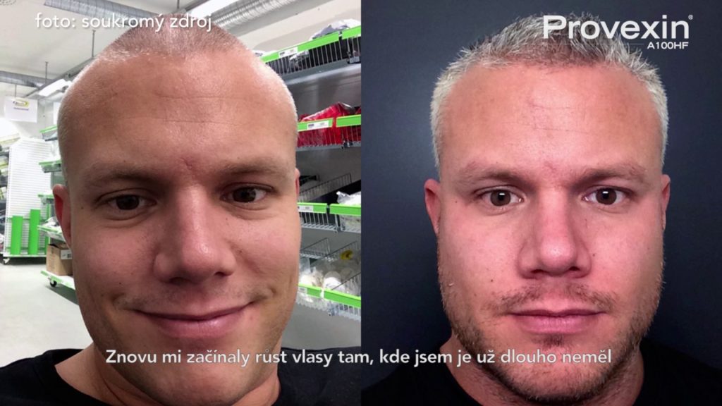 Provexin