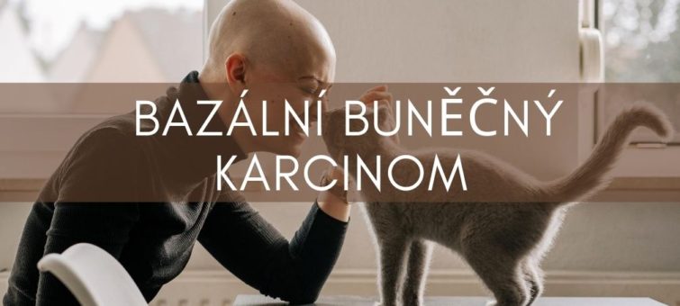 bazální buněčný karcinom
