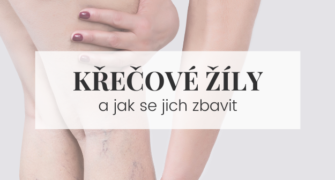 Tipy jak se zbavit křečových žil