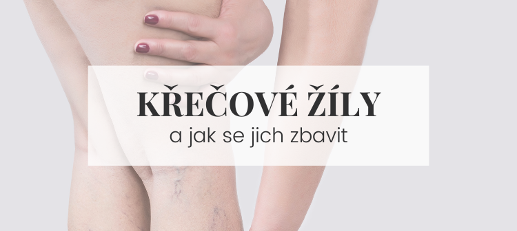 Tipy jak se zbavit křečových žil