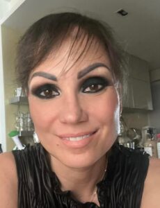 Zastavení Alopecie u žen